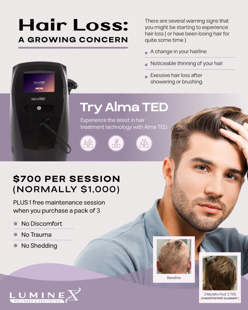 Luminex Wellness & Aesthetics The Most Advanced, Needle-Free Way to Restore Hair Loss is Here